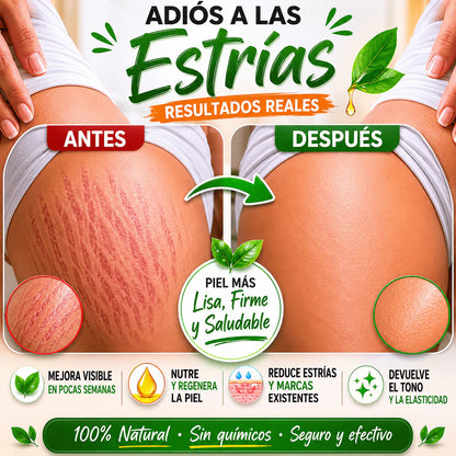 🌿 Aceite de Palo de Canime | Alivio Natural para Piernas Cansadas y Circulación 💆‍♂️✨