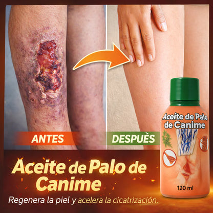 🌿 Aceite de Palo de Canime | Alivio Natural para Piernas Cansadas y Circulación 💆‍♂️✨