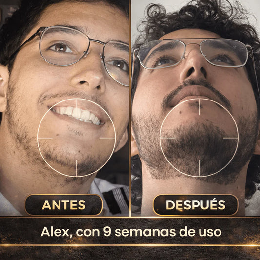 Estimulante de Barba Apolo Ultra Potente 100ml | Más Crecimiento y Densidad