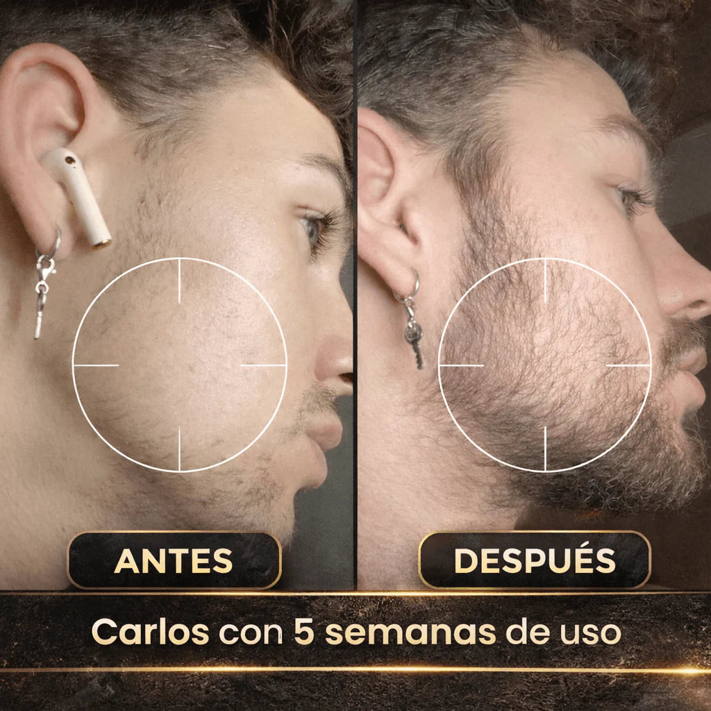 Estimulante de Barba Apolo Ultra Potente 100ml | Más Crecimiento y Densidad VIEJO VIEJO VIEJO