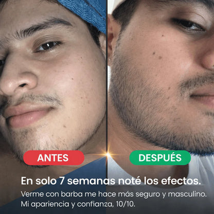 Estimulante de Barba Apolo Ultra Potente 100ml | Más Crecimiento y Densidad VIEJO VIEJO VIEJO