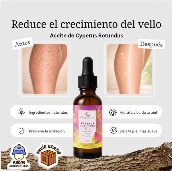 Cyperus Rotundus: Reduce El Crecimiento Del Vello y Revela Una Piel Suave y Perfecta Desde Casa 🧴