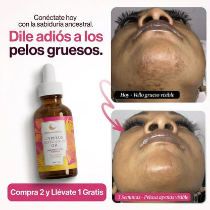 Cyperus Rotundus: Reduce El Crecimiento Del Vello y Revela Una Piel Suave y Perfecta Desde Casa 🧴